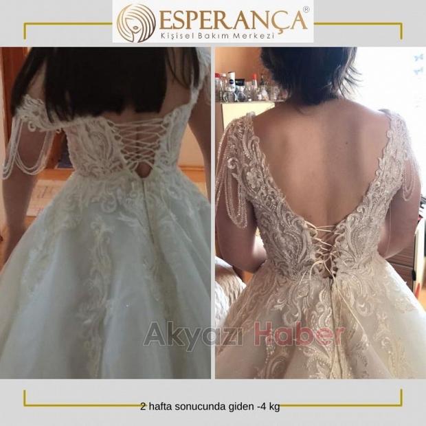 Sonuç garantili kişisel bakım sadece Esperança'da