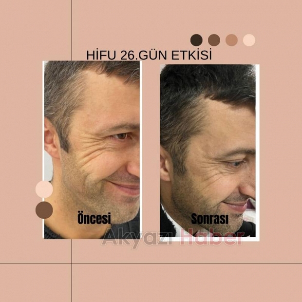 Sonuç garantili kişisel bakım sadece Esperança'da