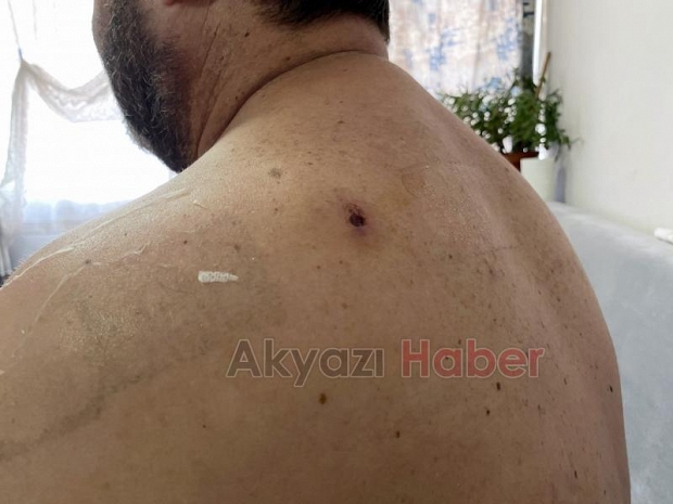 Yorgun mermi isabet etti yerinden fırladı: O anlar kamerada