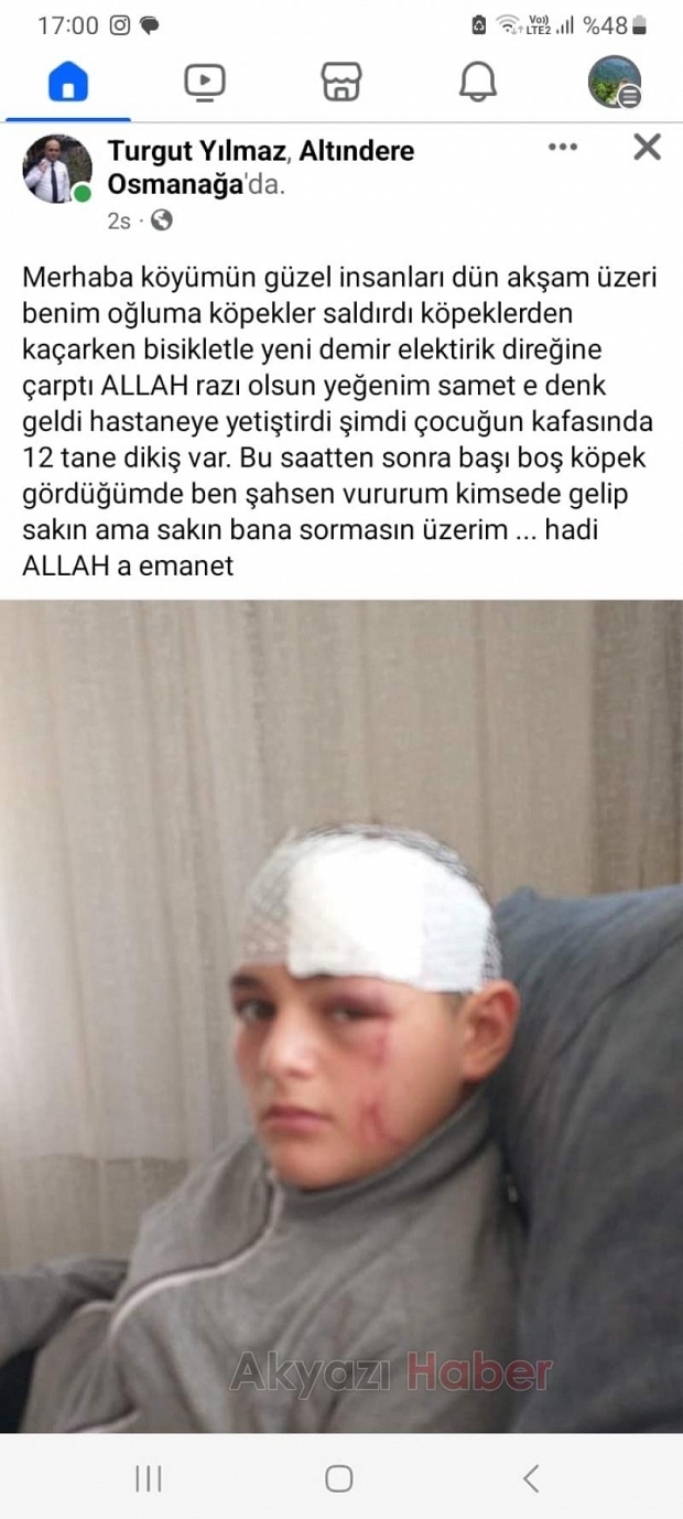 Başıboş köpekler çocuğu bu hale getirdi
