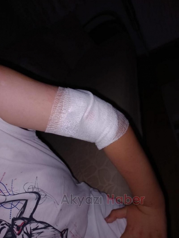 Kurt köpeğinin saldırdığı çocuk yaralandı