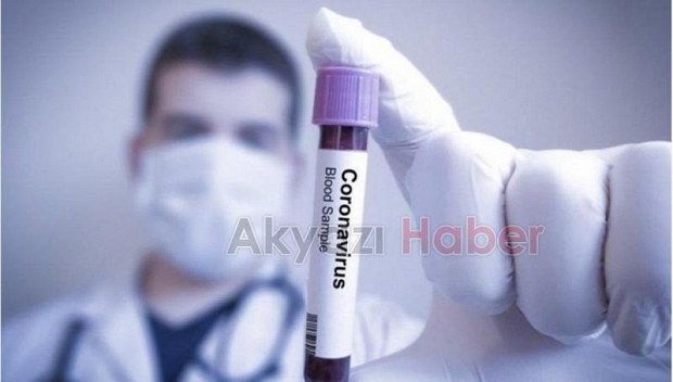 Hasta kanıyla korona tedavisi Türkiyede
