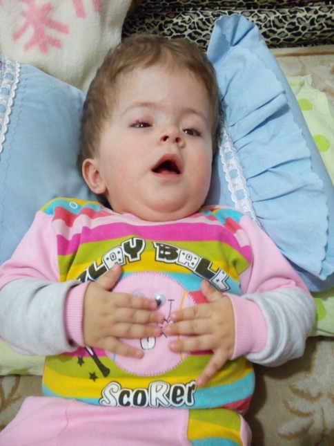 Ümmügülsüm Bebek 2. Ameliyat için Yardım Bekliyor